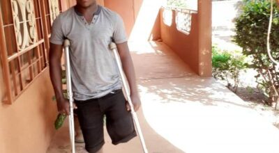 Protesi ortopedica in Burkina Faso